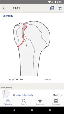 AO/OTA Fracture Classification android App screenshot 11