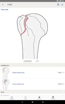 AO/OTA Fracture Classification android App screenshot 1