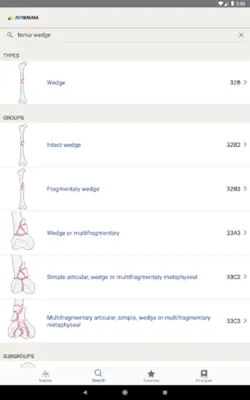 AO/OTA Fracture Classification android App screenshot 2