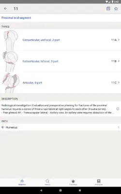 AO/OTA Fracture Classification android App screenshot 3