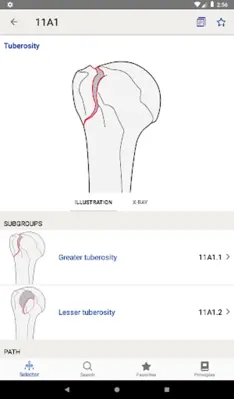 AO/OTA Fracture Classification android App screenshot 6