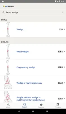 AO/OTA Fracture Classification android App screenshot 7