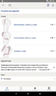 AO/OTA Fracture Classification android App screenshot 8